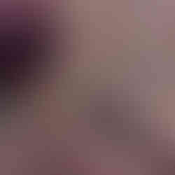 Vermessen der Losung