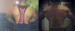 Franz - Posture Correction