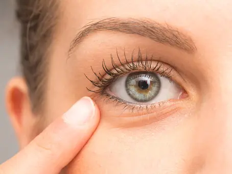 Dubai Dreams: Achieve a Youthful Look with Under-Eye Filler Treatments