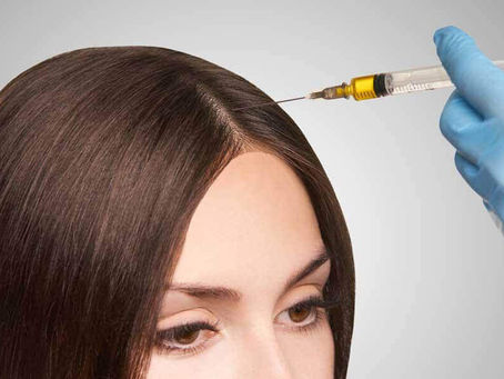 The Best PRP For Hair in Dubai