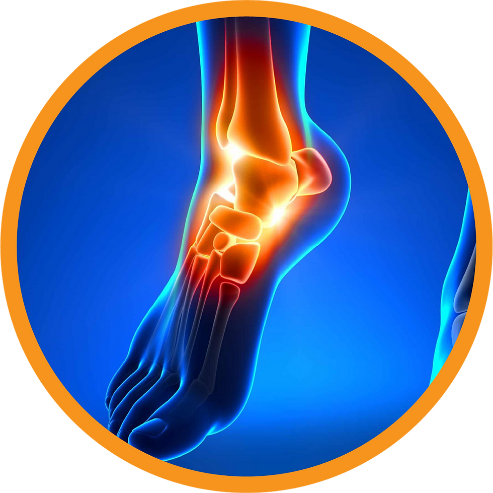 x-ray of an ankle in pain
