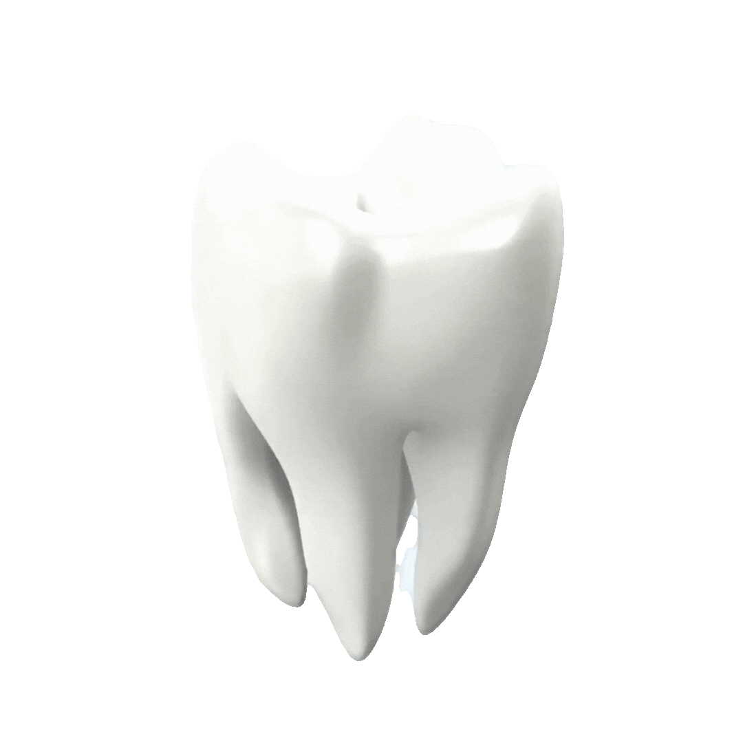 Dent 3D