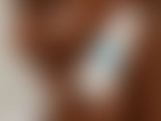 A teen holding a bottle of Upenya Blemish Care with 3 white Blemish Care spots on his cheek