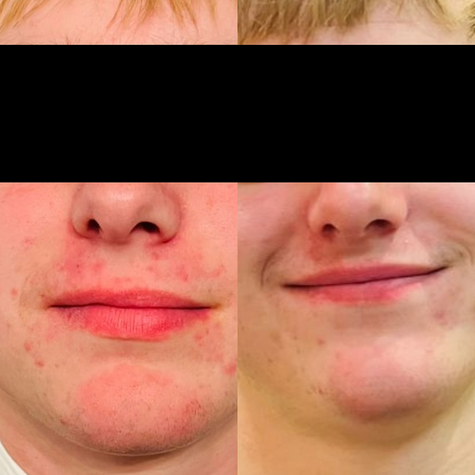 Week 0 and Week 4