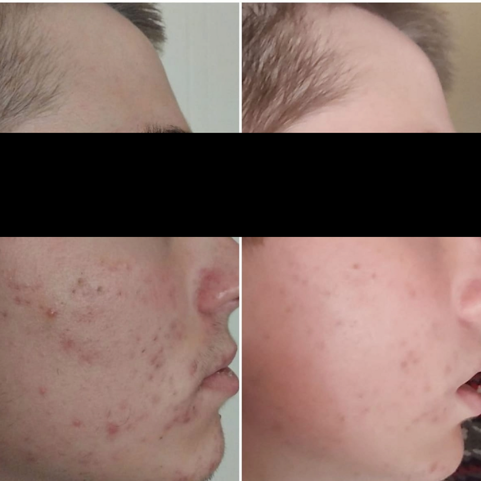 Week 0 and week 4