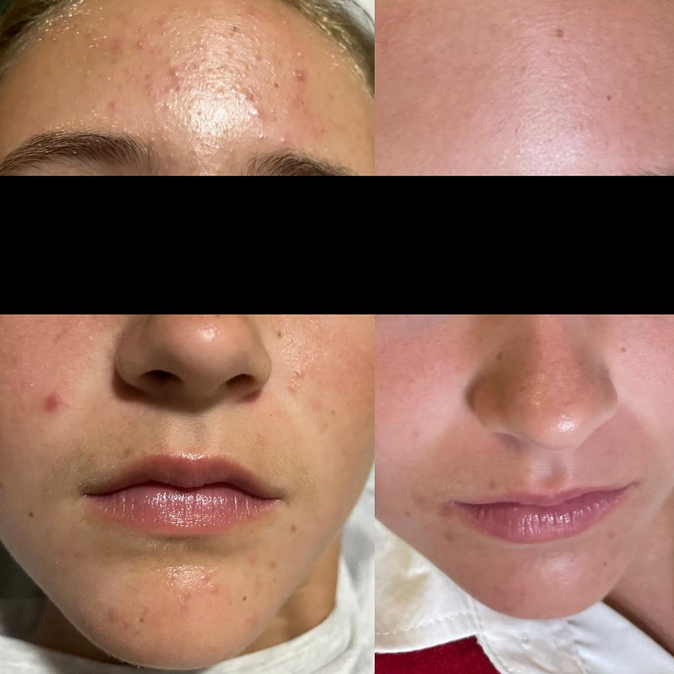 Week 0 and Week 4