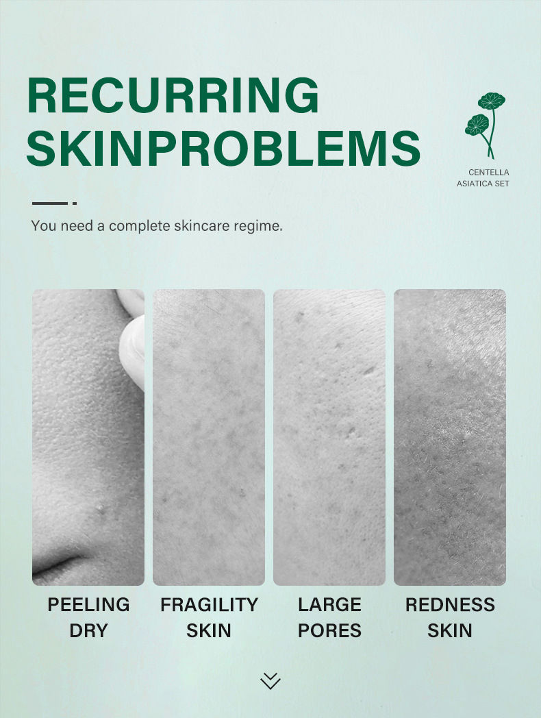 Thumbnail: Centella Asiatica 5-Piece Skincare Set