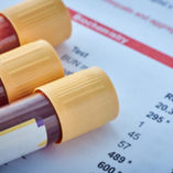 Functional Medicine Testing