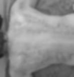 Gua Sha/Muscle Scrape