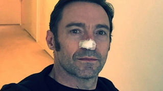 Hugh Jackman de nueva cuenta recibe tratamiento contra cáncer
