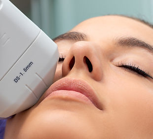 HIFU High-intensity focused ultrasound treatment.jpg