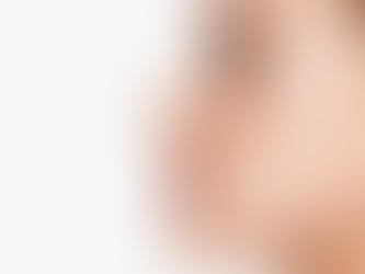 Achieve Flawless Skin with Face Threading in Port Coquitlam