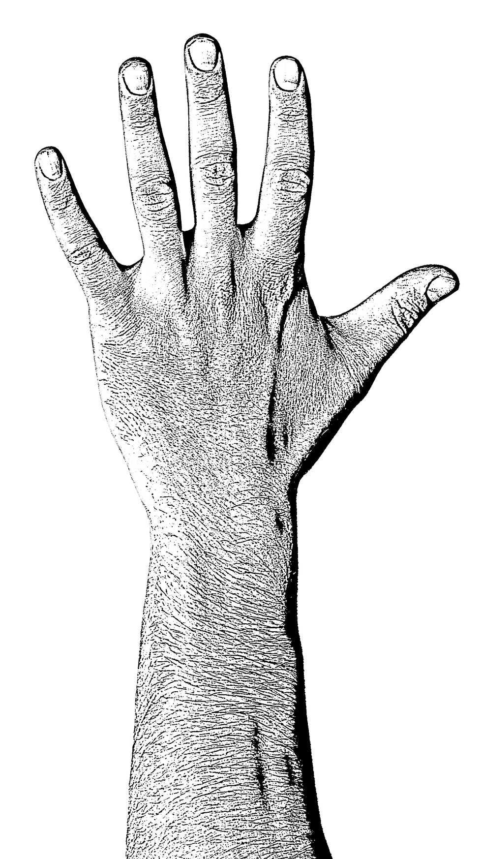 arm_edited.png