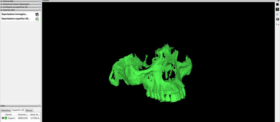 Ecco il software gratuito per ricostruire in 3D una Cone Beam CT