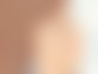 6 ĐIỀU CẦN NHỚ KHI NẶN MỤN