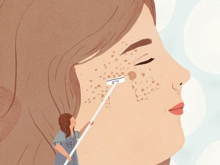 6 ĐIỀU CẦN NHỚ KHI NẶN MỤN