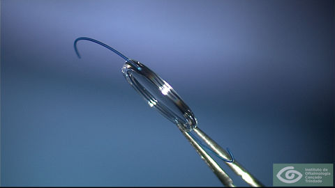 Negative power IOL edge