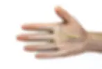 Carpel Tunnel Syndrome Surgery in London and Essex Clinics by Professor Ben Miranda