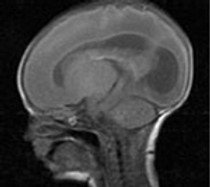 infantbrain1.jpeg