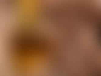 Cedar wood essential oil has numerous benefits for skin and hair: