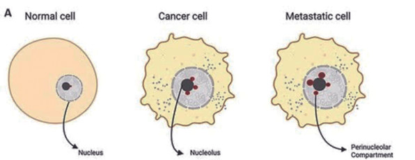 图8b 显示正常细胞与癌症细胞核仁的区别；正常细胞的核及核仁细小，结实平滑（右）。癌症细胞核及核仁扩大，核仁周边呈现渗凸的“外泌分子体”。