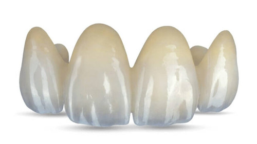 ZIRCONIA CROWN FULL MULTILAYER Coral Gables Dental