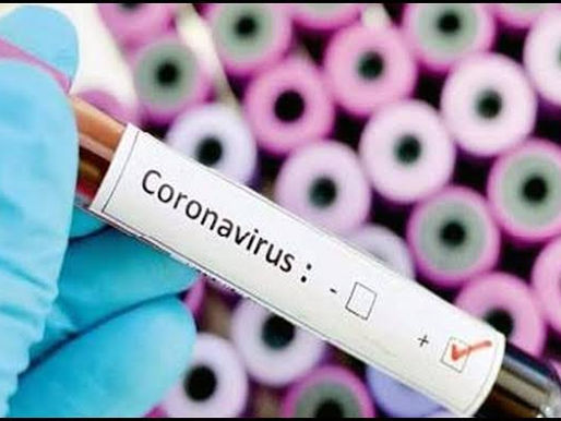 अबब ! औरंगाबाद मध्ये एकाच दिवशी तीस पॉझिटिव्ह...