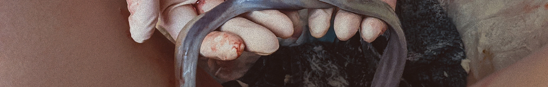 Gloved hands holding umbilical cord filled with whartons jelly