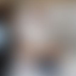 DIAGNOSTICAR A TIEMPO UNA INFECCIÓN DE VÍAS
URINARIAS EN NIÑOS, PREVIENE INSUFICIENCIA RENAL