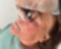 Micro-needling