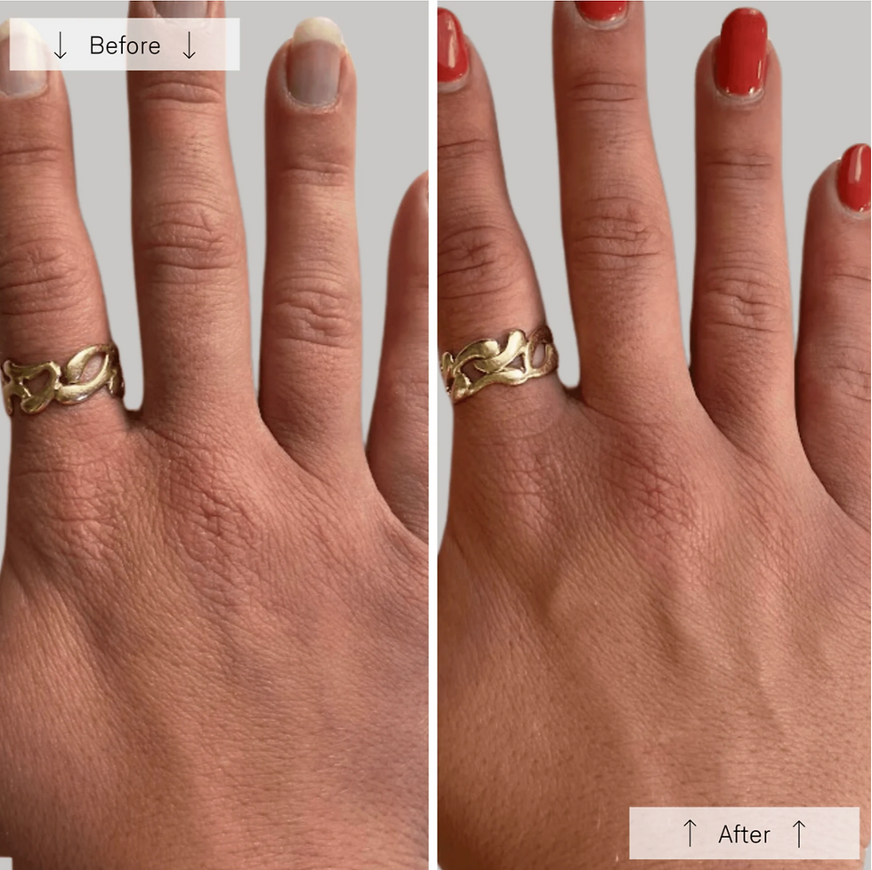 Thumbnail: Omnilux Contour Glove