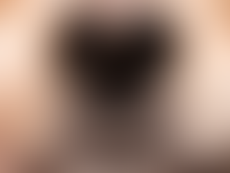 Can Dogs Lose Their Ability to Smell?