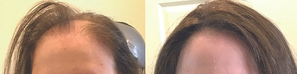 hair systems for women barre ma