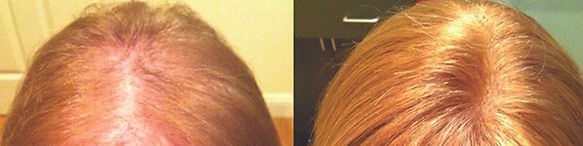 women's hair replacement near townsend ma