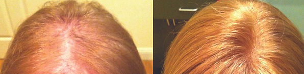 wilmington hair replacement for women