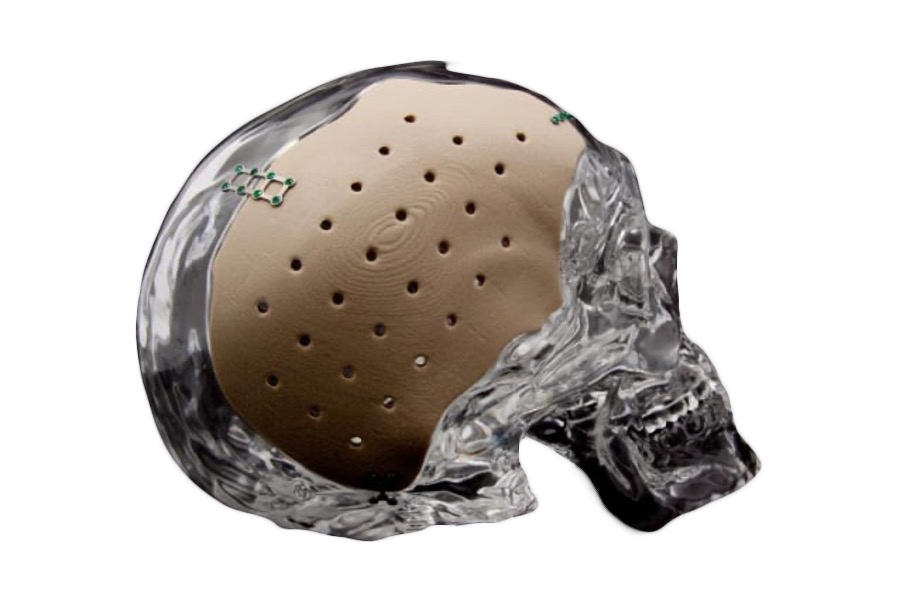 Cranio_cmf.png
