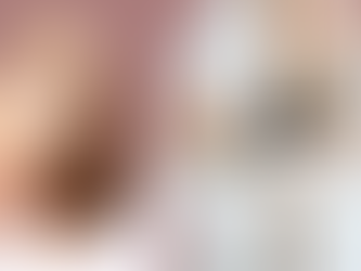 hair loss, body love