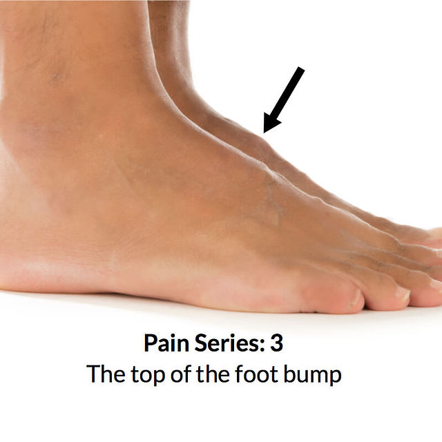 Pain in instep of foot new arrivals