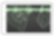 Screenshot 2025-03-23 at 5.18.49 PM.png
