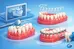 Apiñamiento dental: tratamiento y opciones