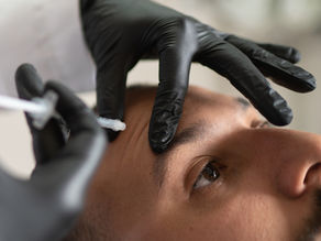 Think Anti-Wrinkle Injections Are Just for Forehead Lines?