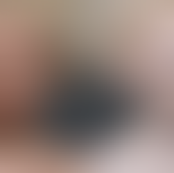 Albinism and the Hair That Was Never Colored
