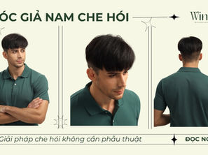 Mua Tóc Giả Nam Che Hói Uy Tín Và Chất Lượng Tại TP Hồ Chí Minh?