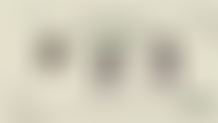 Tóc Mái Giả Che Hói Nữ: Giải Pháp "Hồi Xuân" 5 Phút Cho Chị Em Phụ Nữ