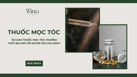 Tại Sao Thuốc Mọc Tóc Thường Thất Bại Đối Với Người Hói Lâu Năm?