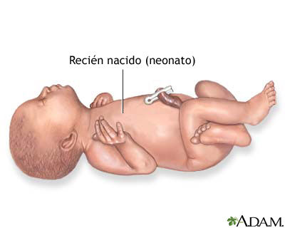 Cuidados Basicos hacia los Neonatales