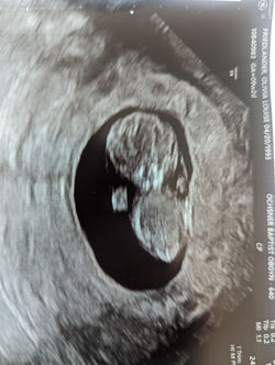 Itty Bitty Prune Sized