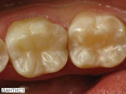 Лечение зубов г. Сумы