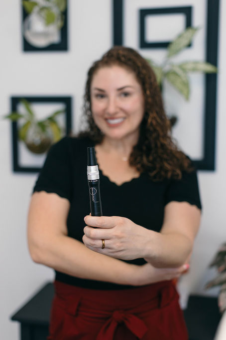 Can Microneedling Help with Hyperpigmentation?