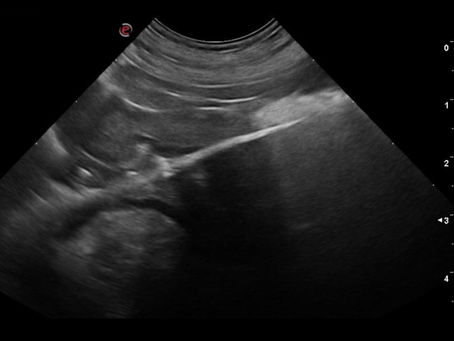 Gastric foreign body in a dog